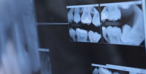 dental xray example